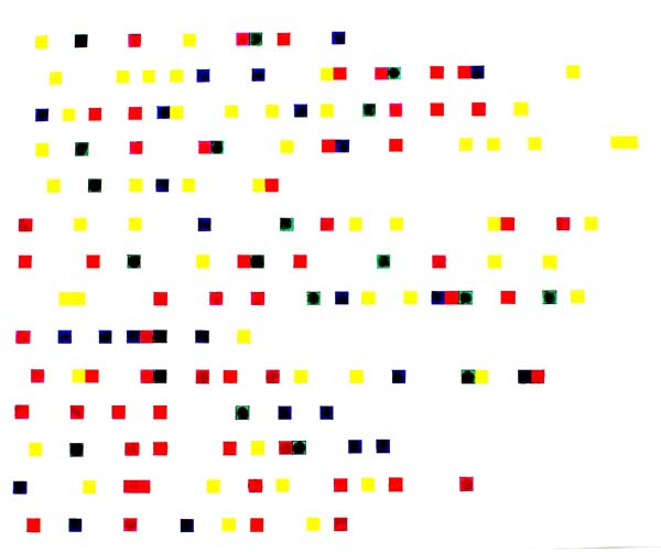 Vowels in Dyslexia